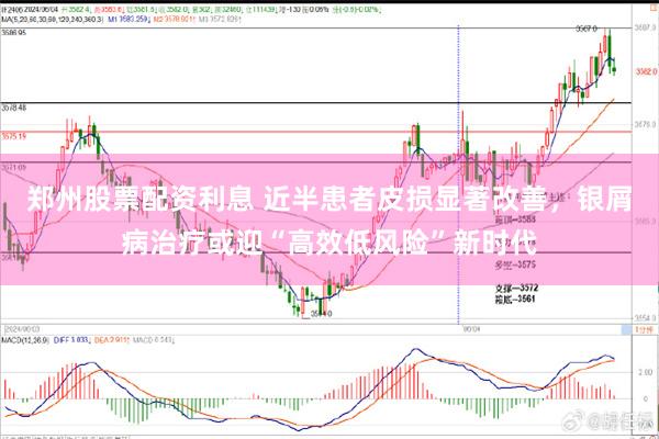 郑州股票配资利息 近半患者皮损显著改善，银屑病治疗或迎“高效低风险”新时代
